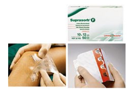 MEDICAZIONE STERILE IN FILM IN POLIURETANO TRASP. SUPRASORB F 10X12CM 10 PEZZI - Farma Nice